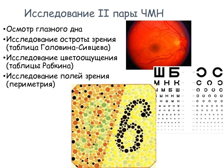 Исследование II пары ЧМН Осмотр глазного дна Исследование остроты зрения