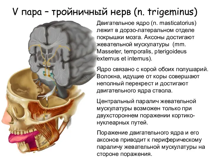 V пара – тройничный нерв (n. trigeminus) Двигательное ядро (n.