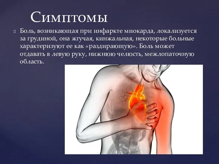 Боль, возникающая при инфаркте миокарда, локализуется за грудиной, она жгучая,