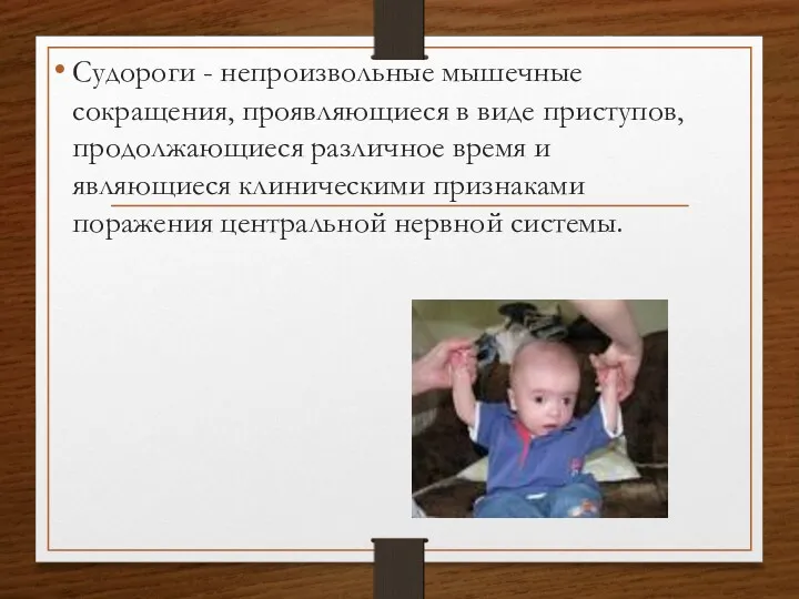 Судороги - непроизвольные мышечные сокращения, проявляющиеся в виде приступов, продолжающиеся