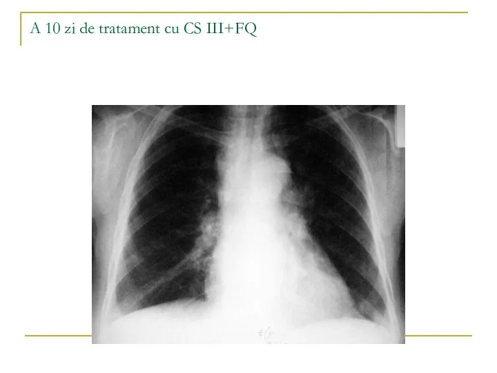 A 10 zi de tratament cu CS III+FQ