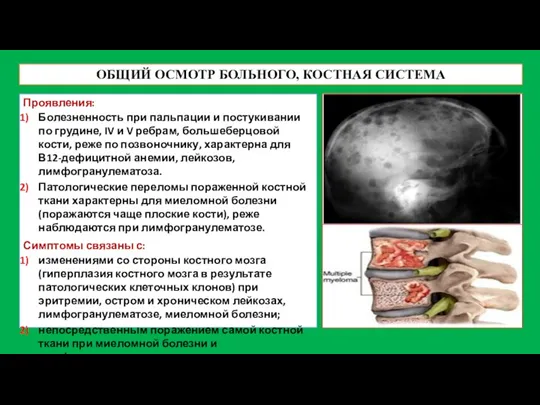 ОБЩИЙ ОСМОТР БОЛЬНОГО, КОСТНАЯ СИСТЕМА Проявления: Болезненность при пальпации и