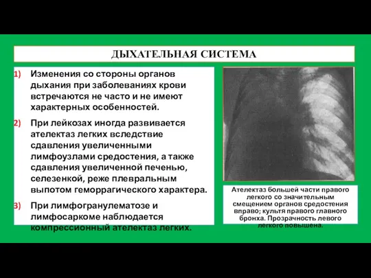 ДЫХАТЕЛЬНАЯ СИСТЕМА Изменения со стороны органов дыхания при заболеваниях крови