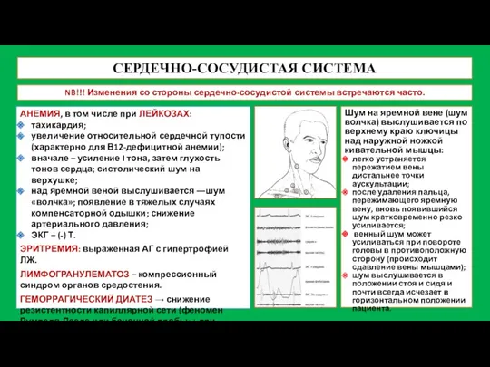 СЕРДЕЧНО-СОСУДИСТАЯ СИСТЕМА NB!!! Изменения со стороны сердечно-сосудистой системы встречаются часто.