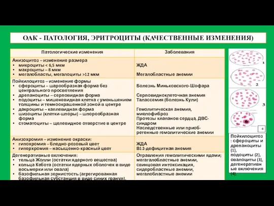 ОАК - ПАТОЛОГИЯ, ЭРИТРОЦИТЫ (КАЧЕСТВЕННЫЕ ИЗМЕНЕНИЯ) Пойкилоцитоз: сфероциты и дрепаноциты
