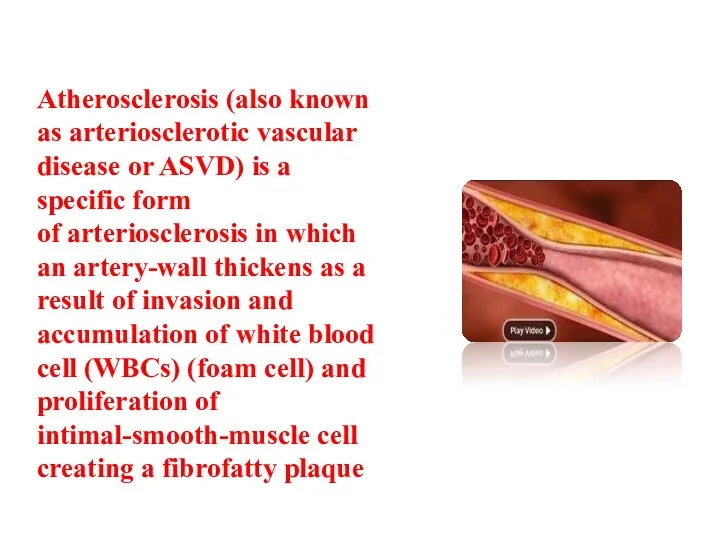 Atherosclerosis (also known as arteriosclerotic vascular disease or ASVD) is