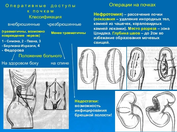 О п е р а т и в н ы