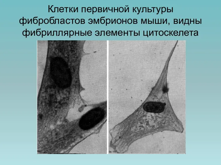 Клетки первичной культуры фибробластов эмбрионов мыши, видны фибриллярные элементы цитоскелета