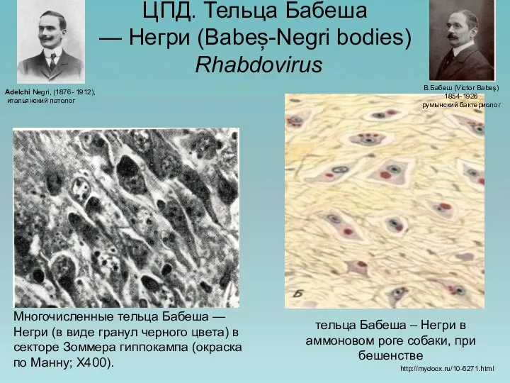 ЦПД. Тельца Бабеша — Негри (Babeș-Negri bodies) Rhabdovirus Многочисленные тельца