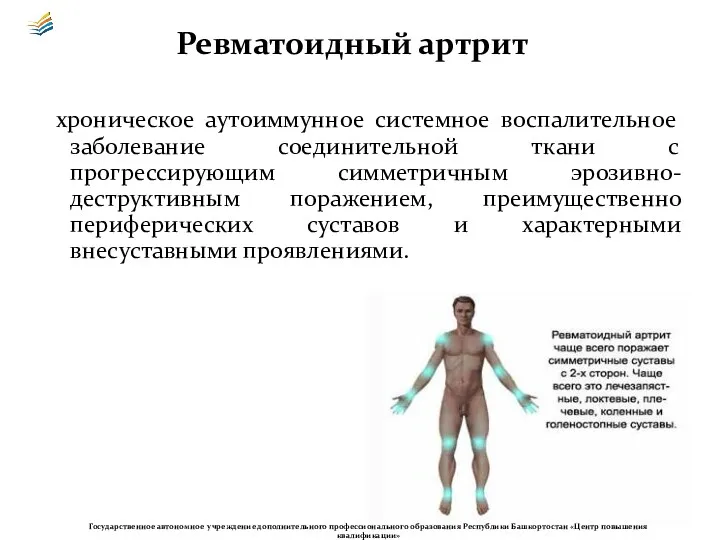 Ревматоидный артрит Государственное автономное учреждение дополнительного профессионального образования Республики Башкортостан