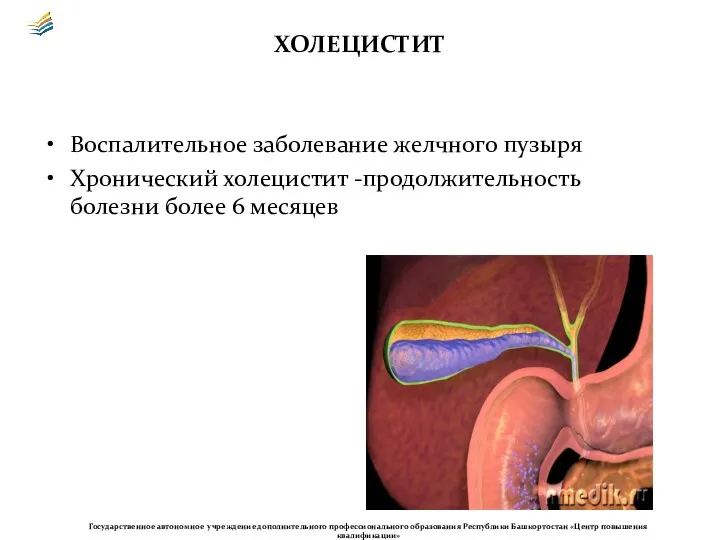 ХОЛЕЦИСТИТ Воспалительное заболевание желчного пузыря Хронический холецистит -продолжительность болезни более