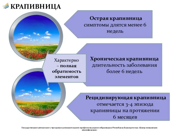 КРАПИВНИЦА Острая крапивница симптомы длятся менее 6 недель Хроническая крапивница