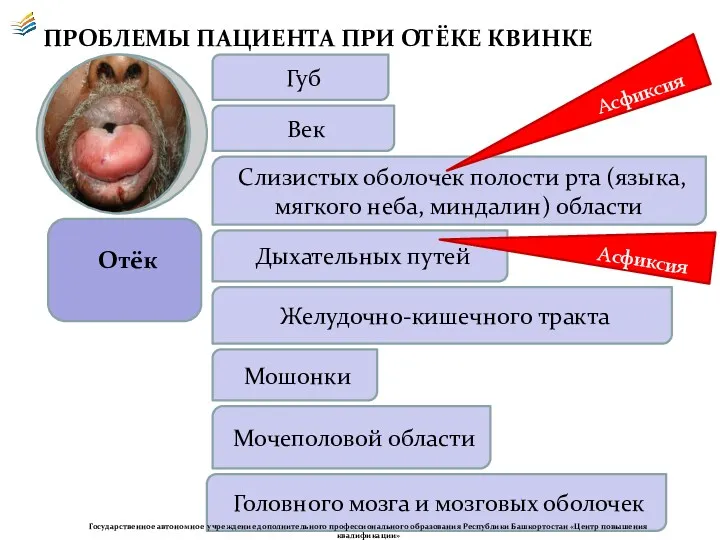 ПРОБЛЕМЫ ПАЦИЕНТА ПРИ ОТЁКЕ КВИНКЕ Отёк Губ Век Мошонки Слизистых