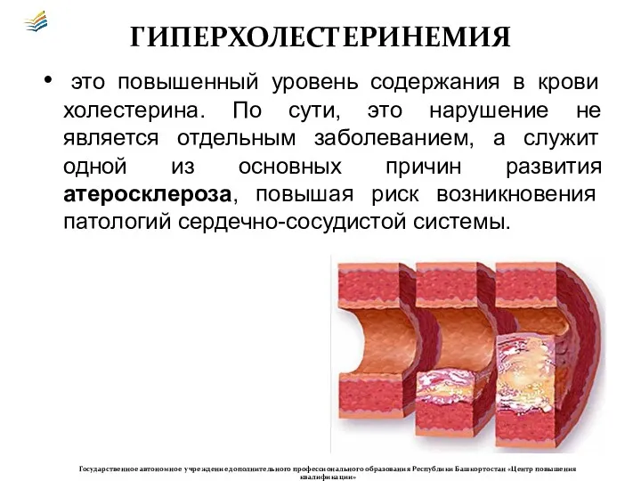 ГИПЕРХОЛЕСТЕРИНЕМИЯ это повышенный уровень содержания в крови холестерина. По сути,