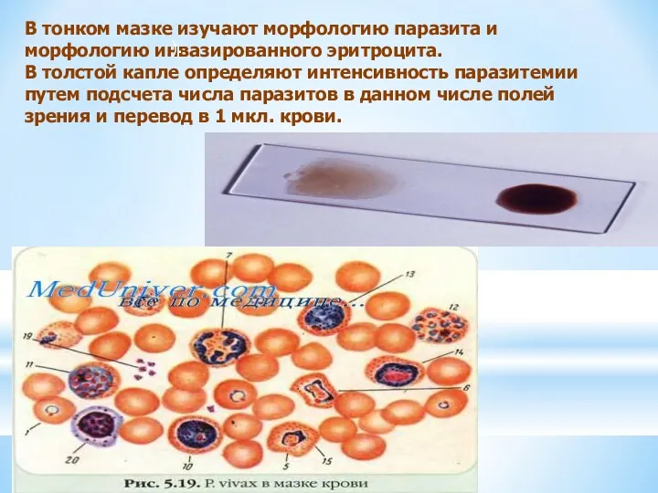 В тонком мазке изучают морфологию паразита и морфологию инвазированного эритроцита.