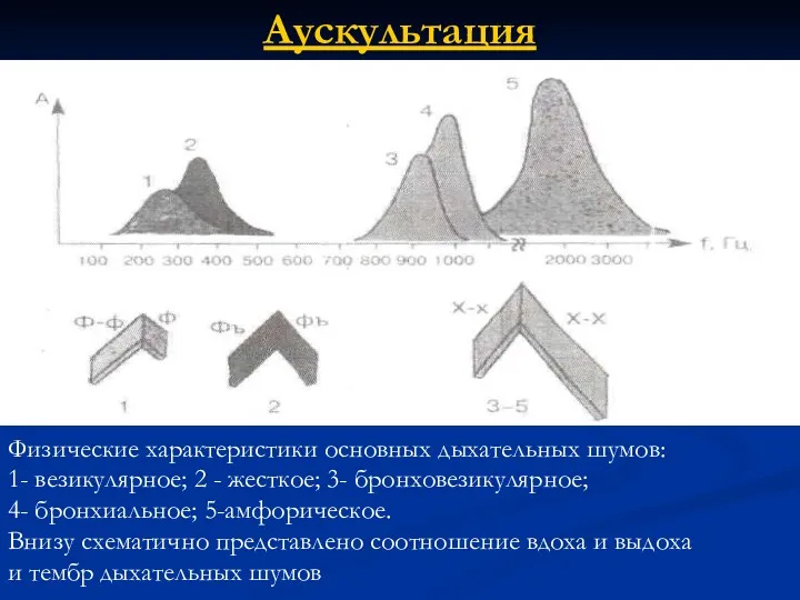 Аускультация Физические характеристики основных дыхательных шумов: 1- везикулярное; 2 -