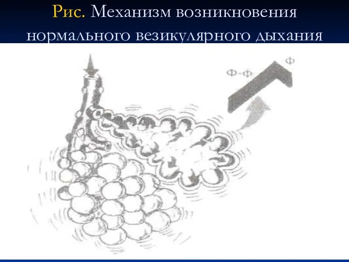 Рис. Механизм возникновения нормального везикулярного дыхания