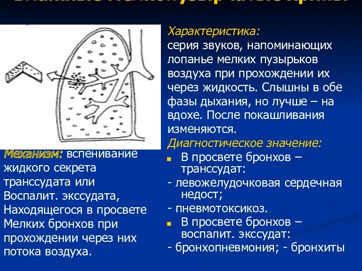 Влажные мелкопузырчатые хрипы Механизм: вспенивание жидкого секрета транссудата или Воспалит.