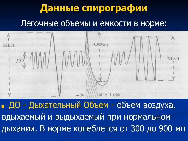 Данные спирографии Легочные объемы и емкости в норме: ДО -