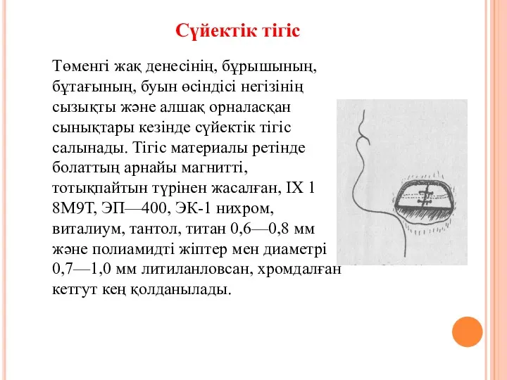 Төменгі жақ денесінің, бұрышының, бұтағының, буын өсіндісі негізінің сызықты және