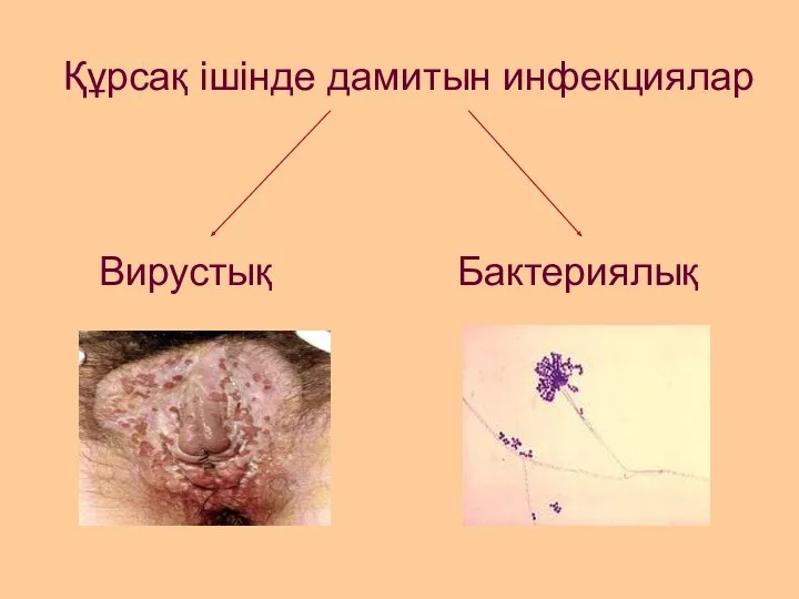 Құрсақ ішінде дамитын инфекциялар Вирустық Бактериялық