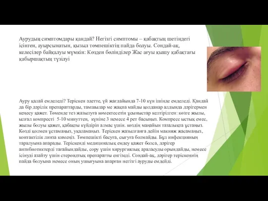 Аурудың симптомдары қандай? Негізгі симптомы – қабақтың шетіндегі ісінген, ауырсынатын,