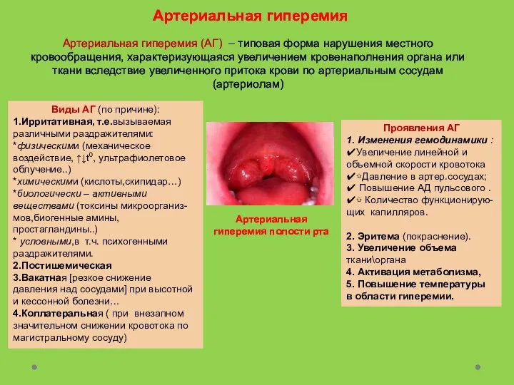 Артериальная гиперемия Артериальная гиперемия (АГ) – типовая форма нарушения местного