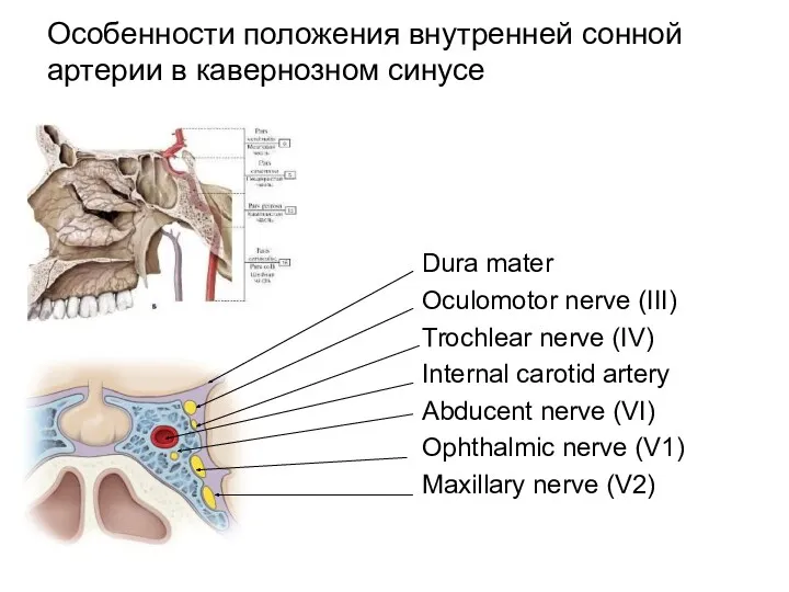 Особенности положения внутренней сонной артерии в кавернозном синусе Dura mater