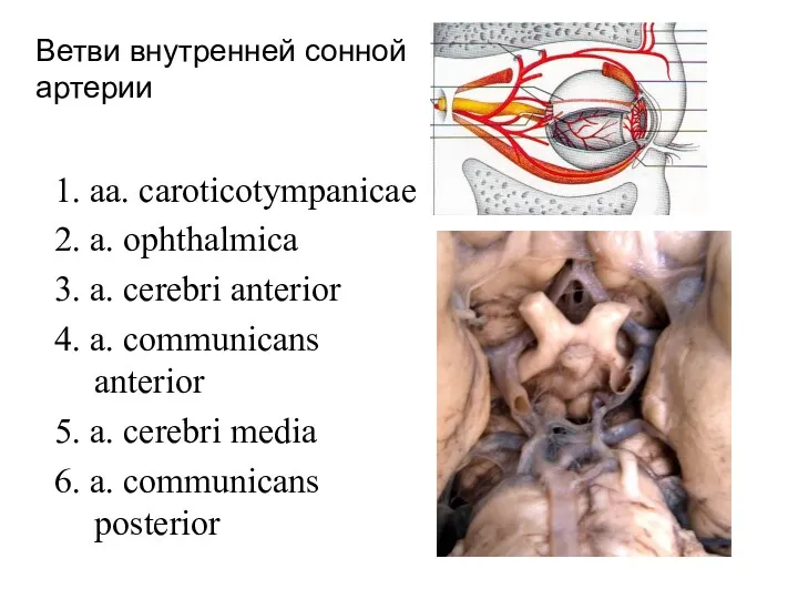 Ветви внутренней сонной артерии 1. aa. caroticotympanicae 2. a. ophthalmica