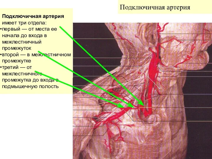 Подключичная артерия Подключичная артерия имеет три отдела: первый — от