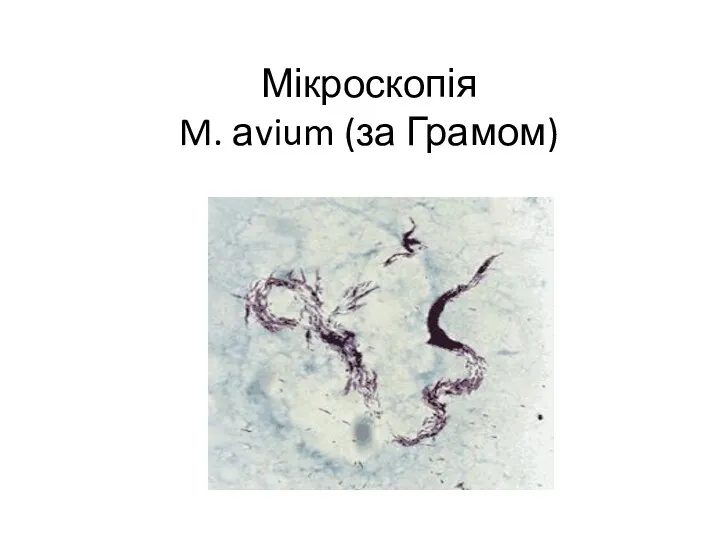 Мікроскопія M. аvium (за Грамом)