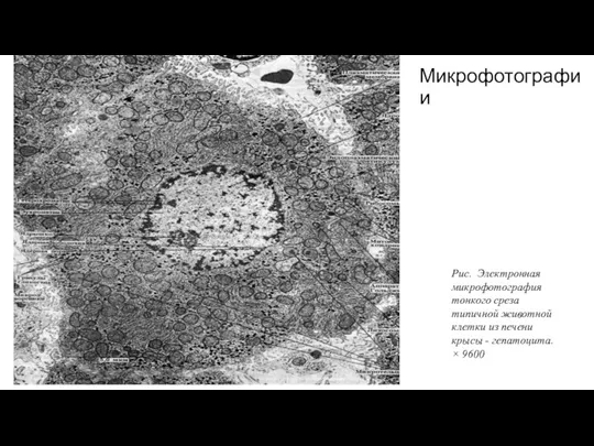 Микрофотографии Рис. Электронная микрофотография тонкого среза типичной животной клетки из печени крысы - гепатоцита. × 9600