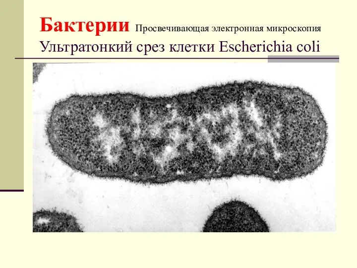 Бактерии Просвечивающая электронная микроскопия Ультратонкий срез клетки Escherichia coli