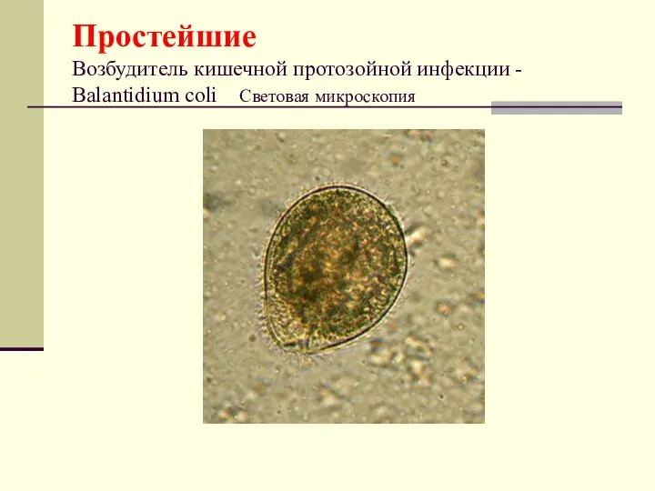 Простейшие Возбудитель кишечной протозойной инфекции - Balantidium coli Световая микроскопия