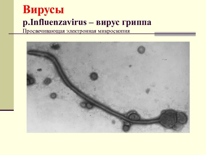 Вирусы р.Influenzavirus – вирус гриппа Просвечивающая электронная микроскопия