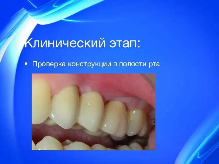 Клинический этап: Проверка конструкции в полости рта