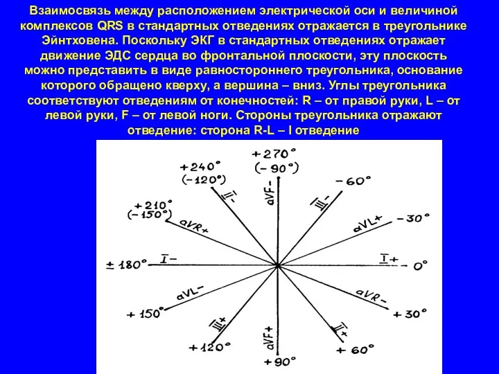 Взаимосвязь между расположением электрической оси и величиной комплексов QRS в стандартных отведениях отражается