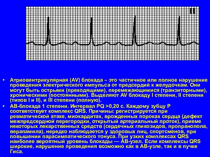 Атриовентрикулярная (AV) блокада – это частичное или полное нарушение проведения электрического импульса от