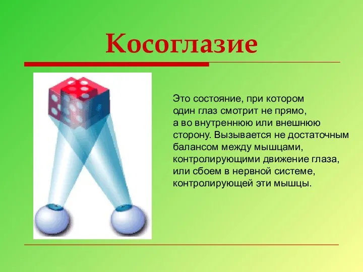 Косоглазие Это состояние, при котором один глаз смотрит не прямо,