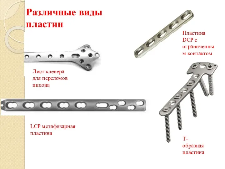 Различные виды пластин Лист клевера для переломов пилона LCP метафизарная