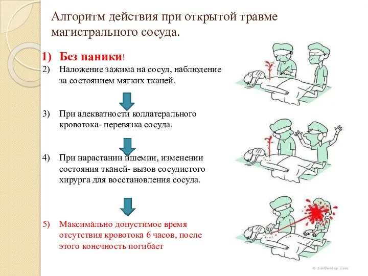 Алгоритм действия при открытой травме магистрального сосуда. Без паники! Наложение