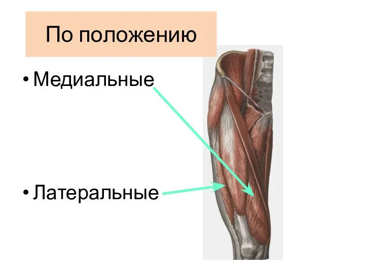 По положению Медиальные Латеральные