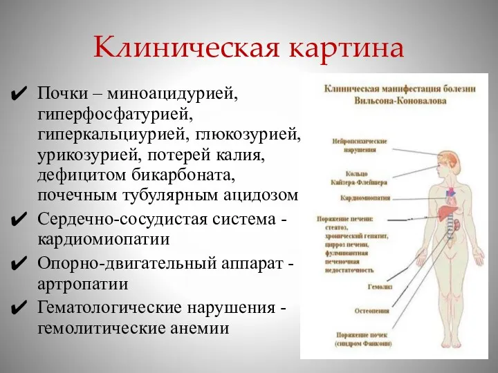 Клиническая картина Почки – миноацидурией, гиперфосфатурией, гиперкальциурией, глюкозурией, урикозурией, потерей