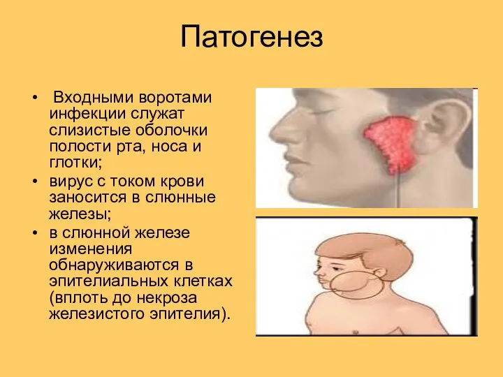 Патогенез Входными воротами инфекции служат слизистые оболочки полости рта, носа