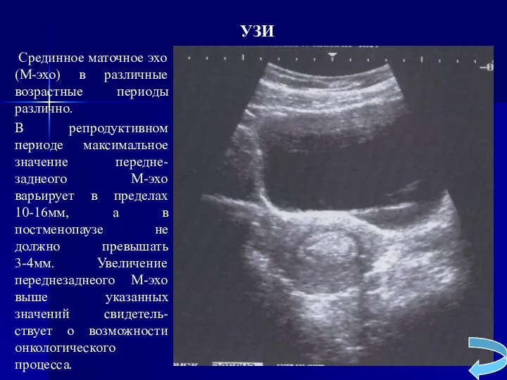 УЗИ Срединное маточное эхо (М-эхо) в различные возрастные периоды различно.
