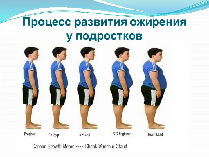 Процесс развития ожирения у подростков Ожирение часто сопровождается отеками ног. Отеки вызваны нарушением