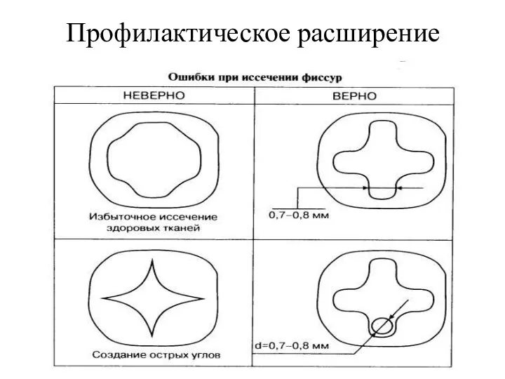 Профилактическое расширение