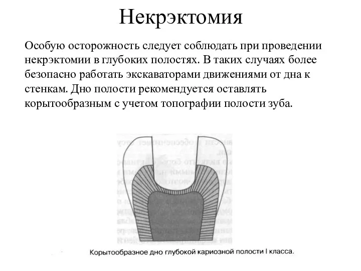 Некрэктомия Особую осторожность следует соблюдать при проведении некрэктомии в глубоких