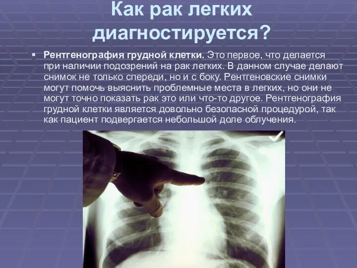 Как рак легких диагностируется? Рентгенография грудной клетки. Это первое, что