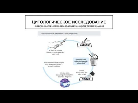 ЦИТОЛОГИЧЕСКОЕ ИССЛЕДОВАНИЕ - микроскопическое исследование окрашенных мазков